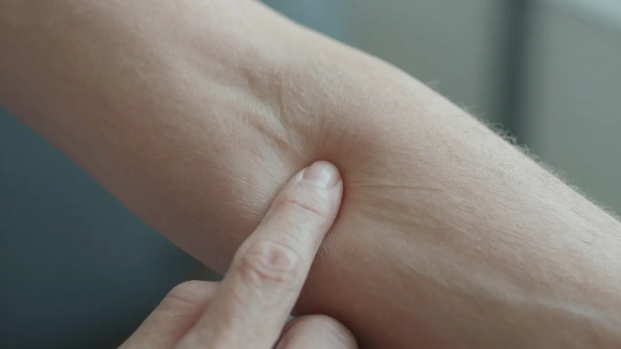 Jak se projevuje nedostatek kolagenu? Příznaky, které byste neměli ignorovat