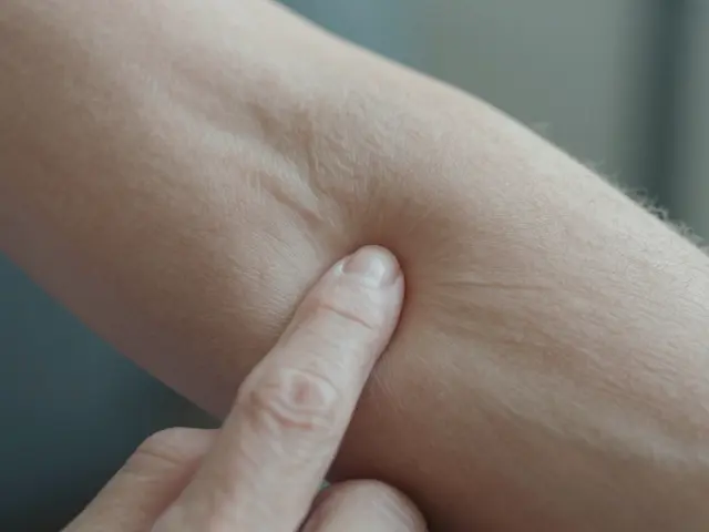 Jak se projevuje nedostatek kolagenu? Příznaky, které byste neměli ignorovat